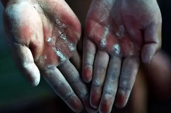 我的爸爸是一個做磨料磨具的工人... 我的爸爸是一個做磨料磨具的工人...